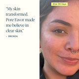 Clear Skin Supplement