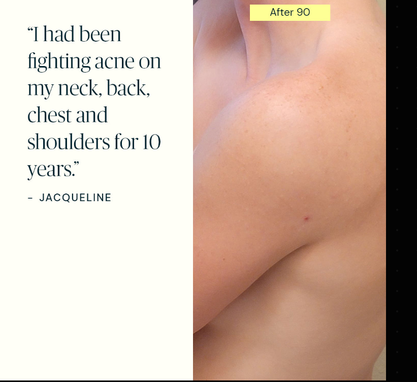 Clear Skin Supplement